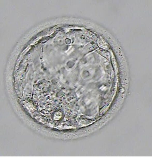 How does the surrogacy embryo transfer process work