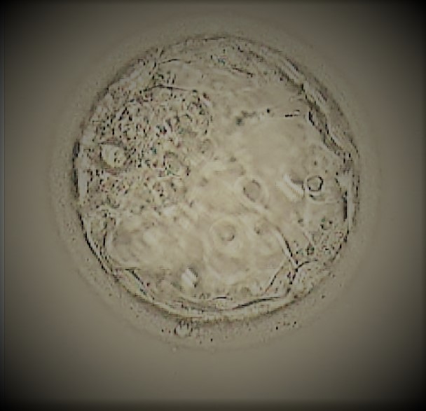 Surrogacy Embryo Transfer – Transfer Day!