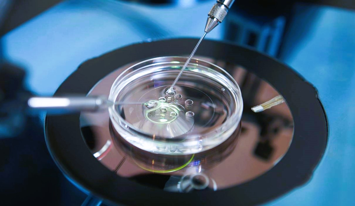 The Alabama Ruling on Embryos: Its Impact on IVF and Surrogacy